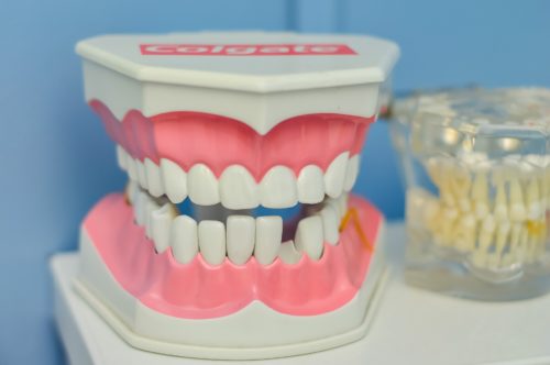 missing tooth dental bridge
