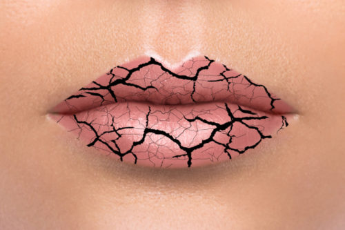 treat dry mouth
