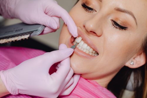 veneers vs. bonding dentist teeth patient