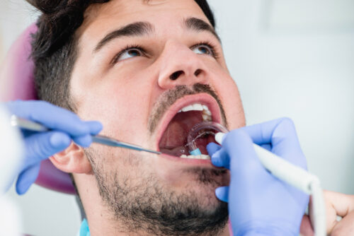 man getting his teeth cleaned by a dentist