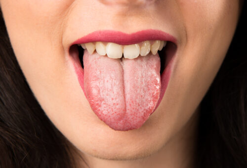 mouth teeth tongue