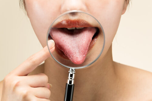 tongue magnifying glass
