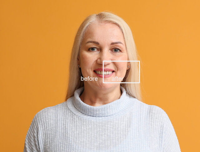 Happy mature woman before and after smile makeover procedure on color background