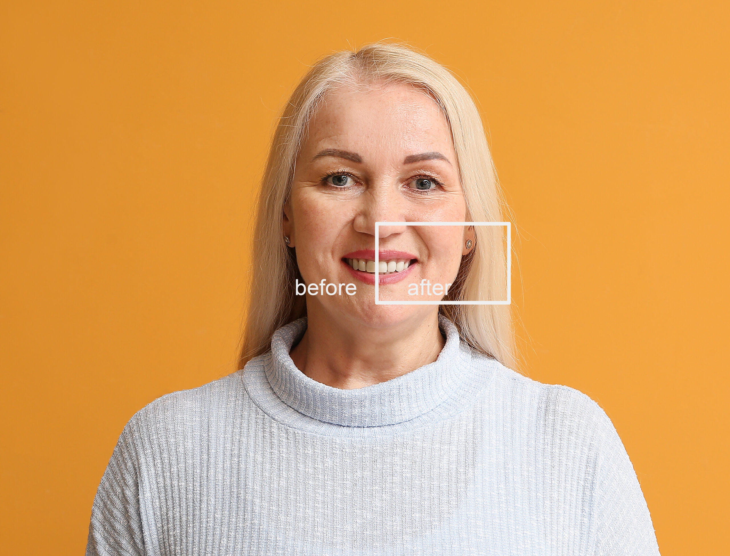 Happy mature woman before and after smile makeover procedure on color background