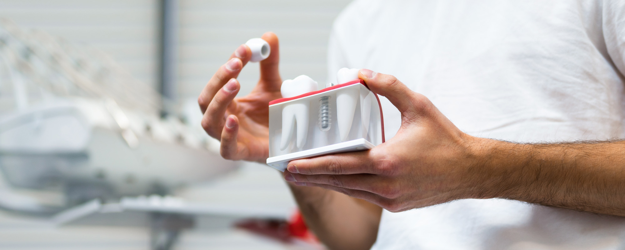 Dentist doctor holding teeth implant model in his hands